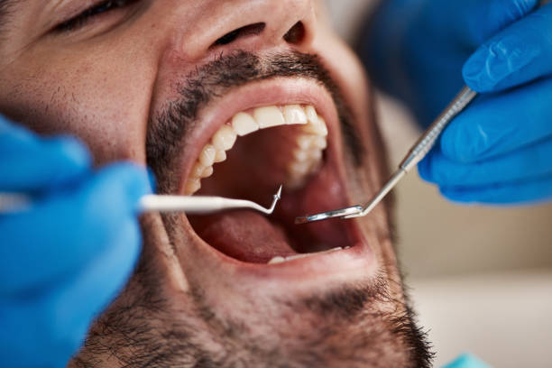 Best Dentist for Tooth Abscess  in Winthrop Harbor, IL